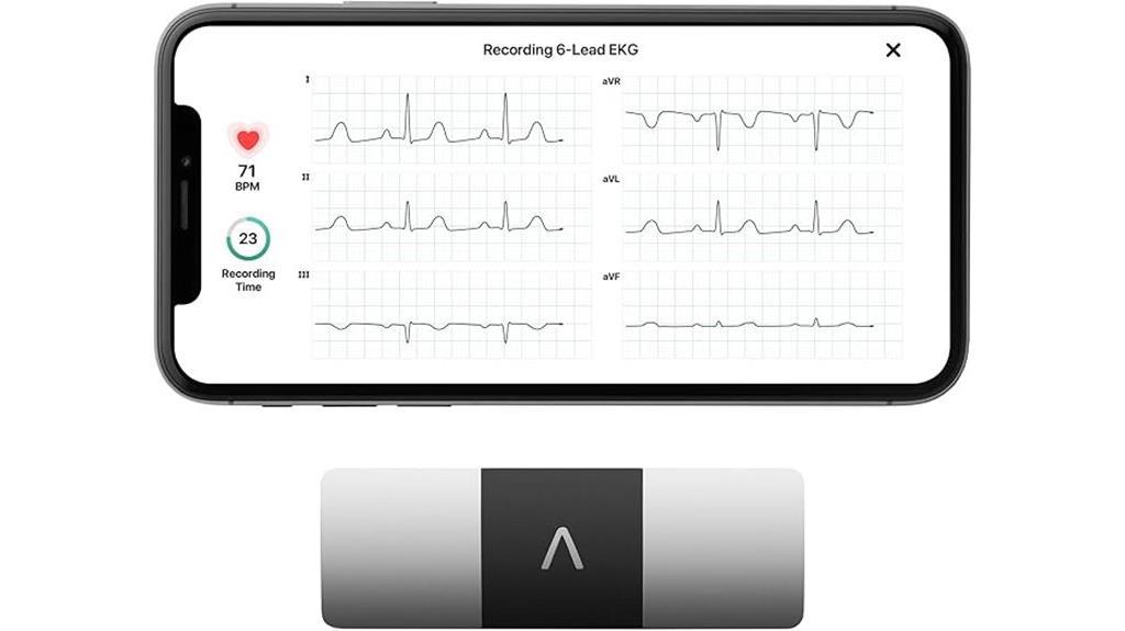 personal ekg monitor device